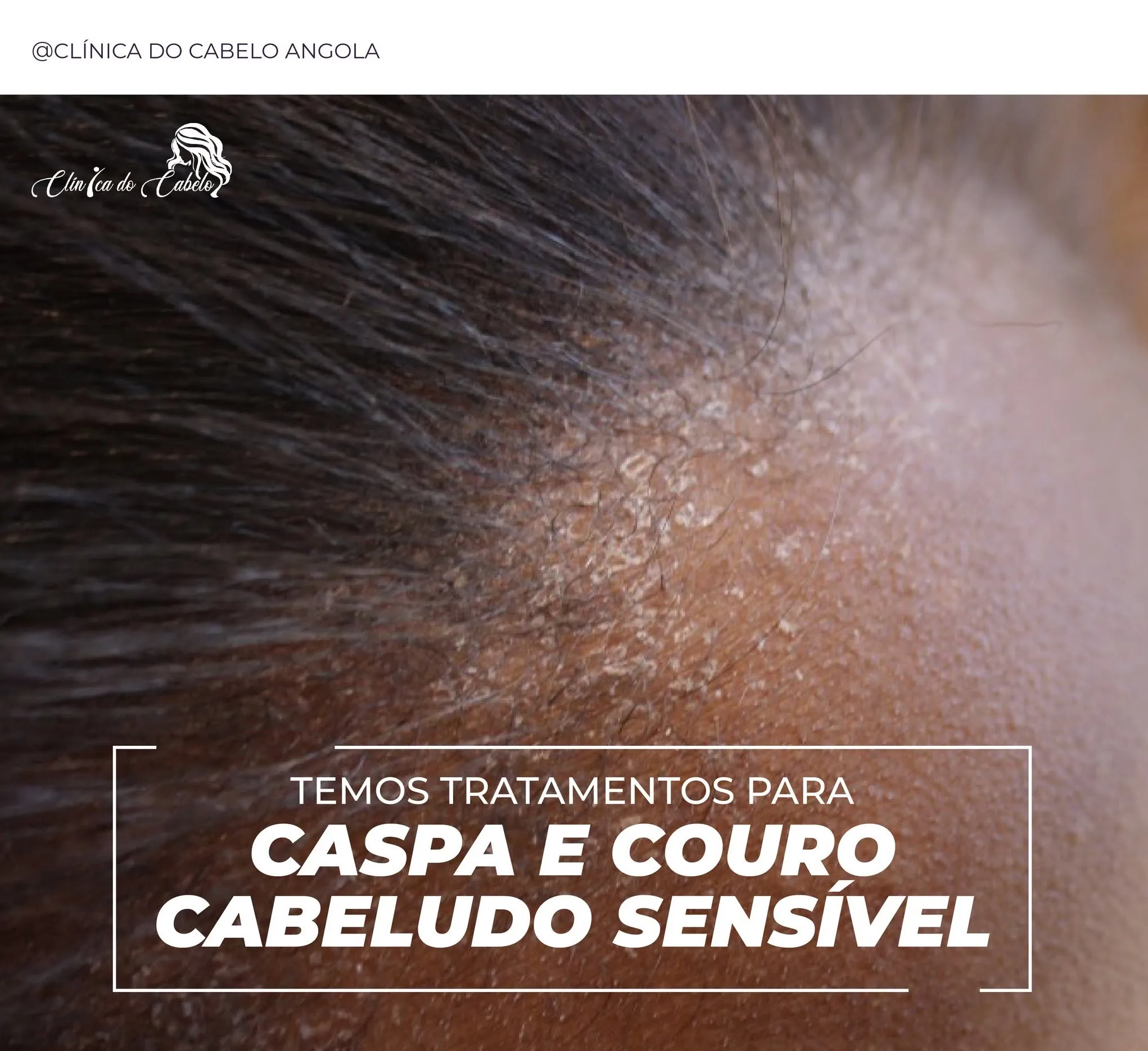 Cabelo Luanda