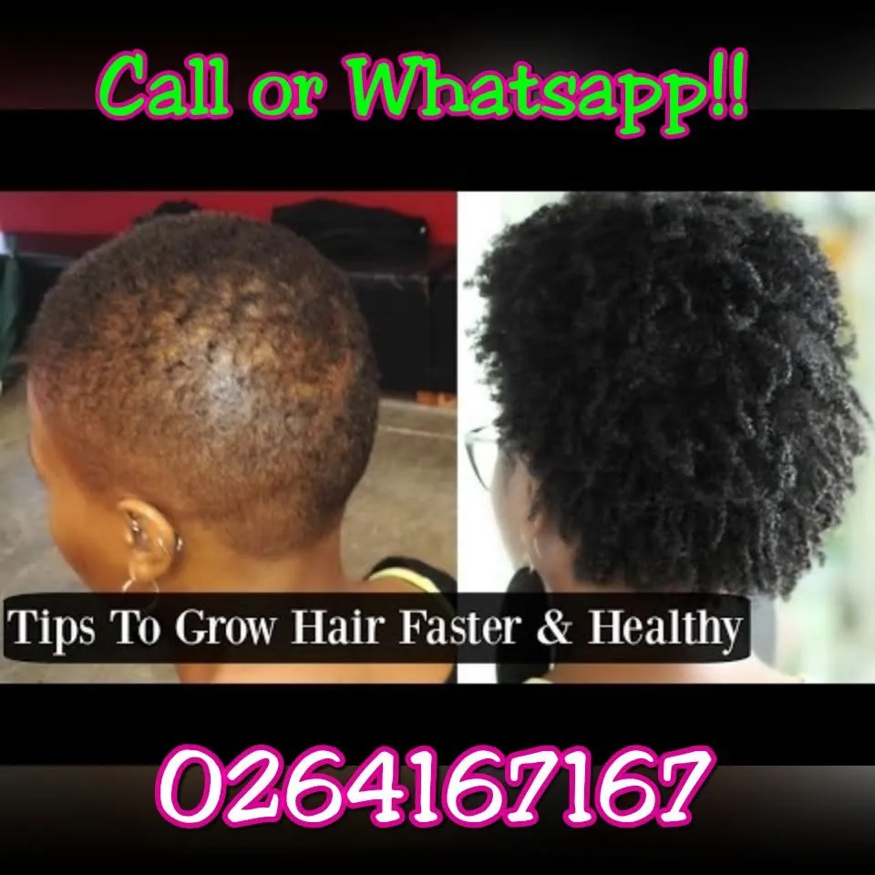 Tyrone Hair Growth Cream Product 1